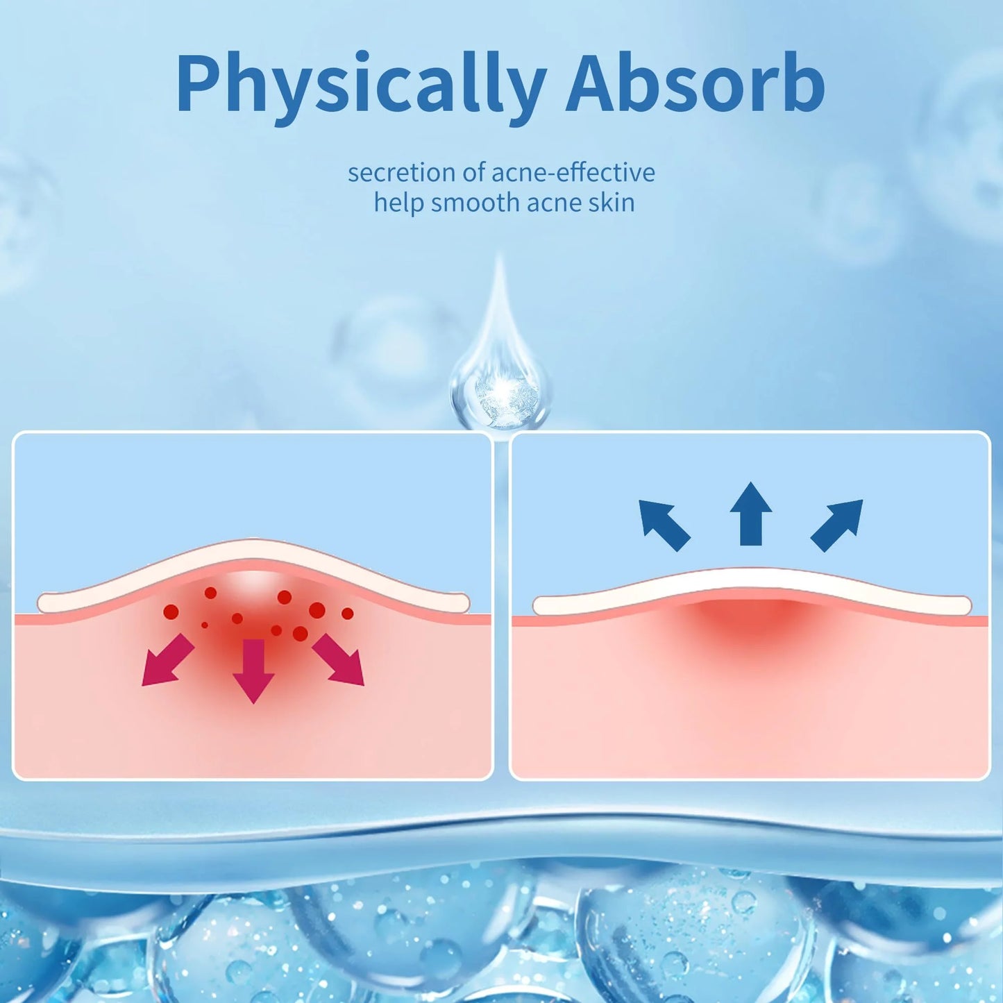 Pimple Patches Set, Hydrocolloid Patches for Covering Zits and Blemishes, Pimples Nose Stick Oval Chin Stick, Spot Stickers for Face and Skin