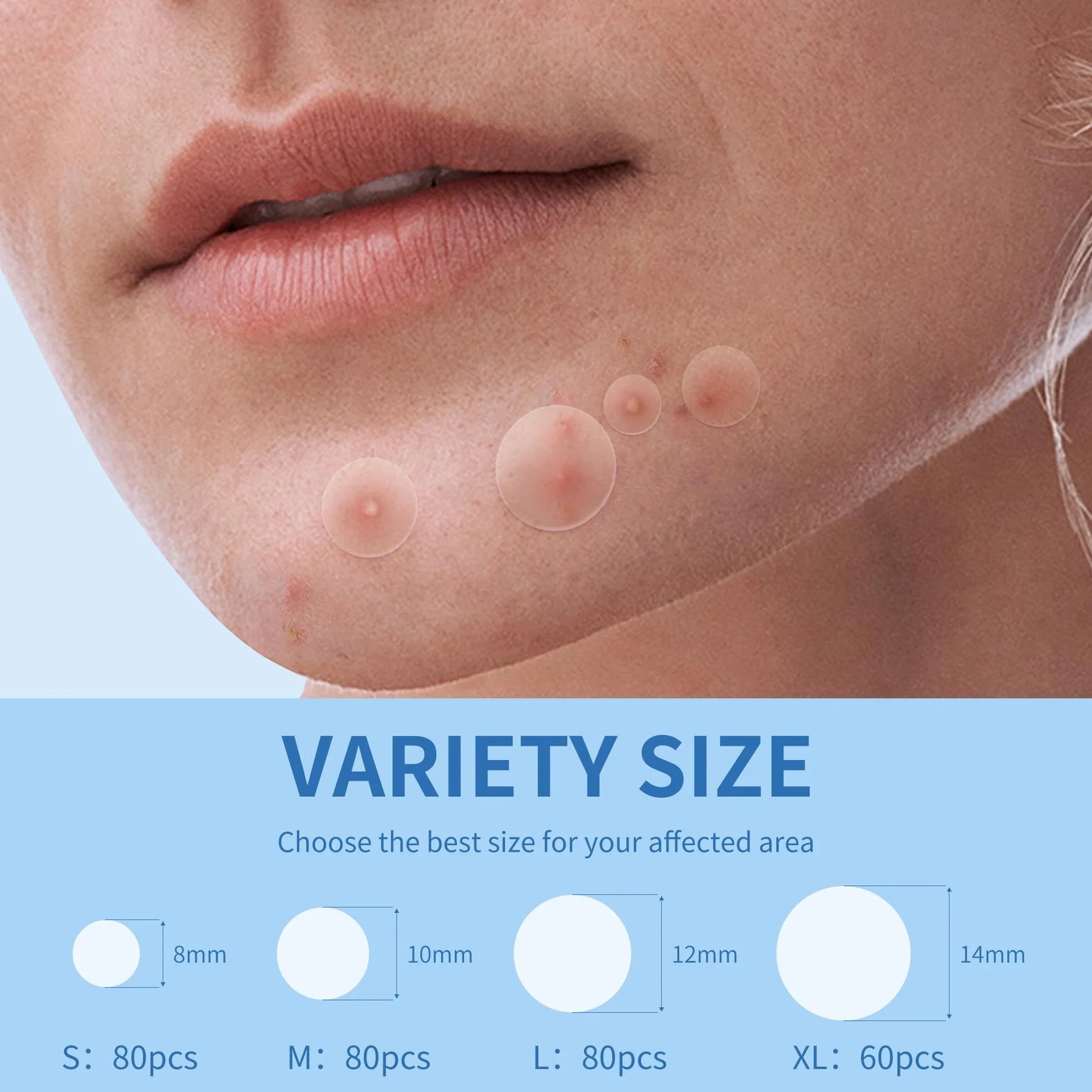 Pimple Patches Set, Hydrocolloid Patches for Covering Zits and Blemishes, Pimples Nose Stick Oval Chin Stick, Spot Stickers for Face and Skin